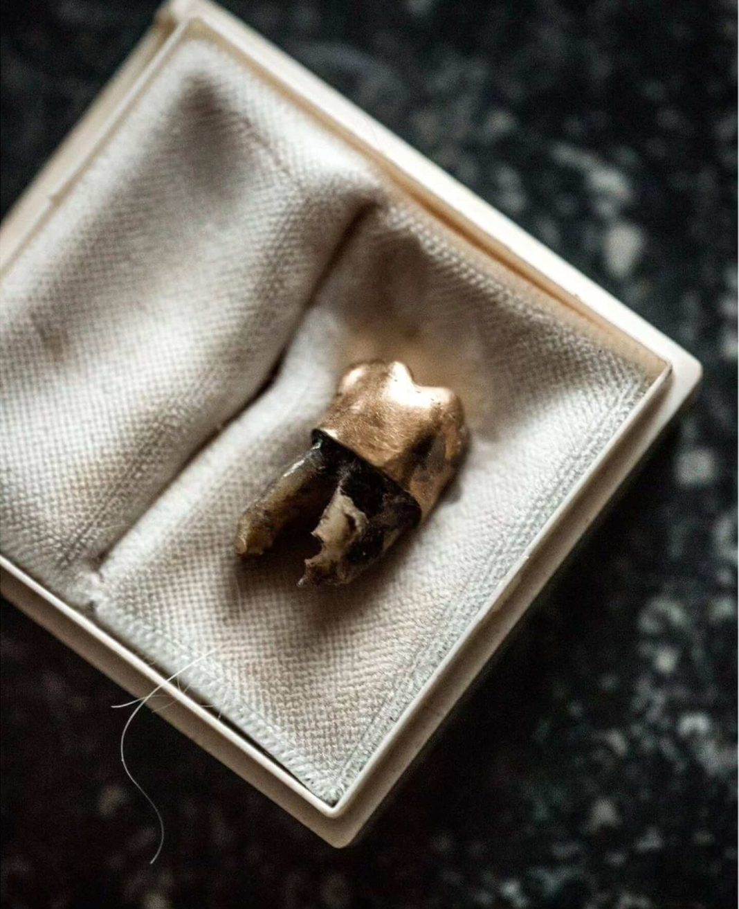 Patrice Lumumba's Gold-Crowned Tooth Finally Laid to Rest After 60 Years