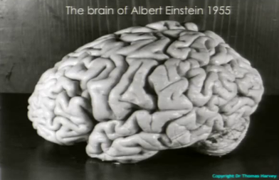 6 Brutal Facts About Albert Einstein: The Dark Side of History’s Greatest Genius